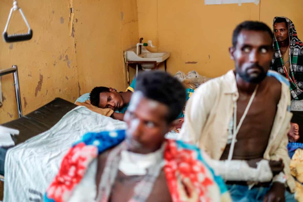 Sopravvissuti al massacro di Mai Kadra, nell'ospedale di Gondar, nel nord dell'Etiopia, nel 2020. Foto: Eduardo Soteras/AFP/Getty Images 
