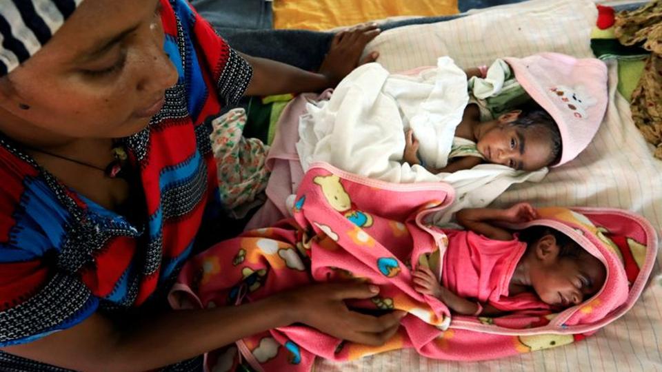 Tigray - fame come arma da guerra - malnutrizione sui bambini