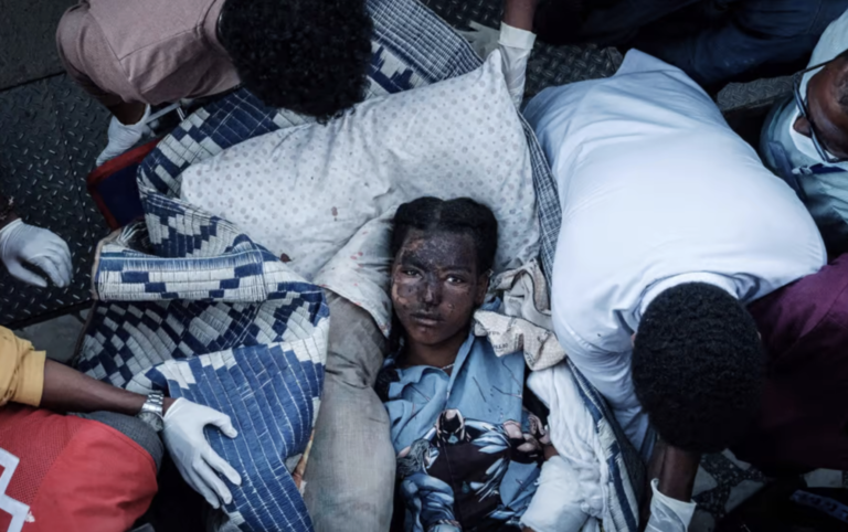 Un residente ferito di Togoga, un villaggio a circa 20 km a ovest di Mekele, arriva in barella all'ospedale di riferimento di Ayder a Mekele, la capitale della regione del Tigray, in Etiopia, nel 2021. (Yasuyoshi Chiba / Getty Images)