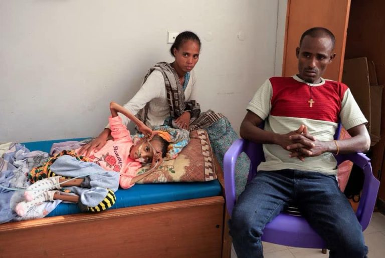 Tsige Shishay, il cui maglione rosa dice "bello" sul davanti, ha 10 anni ma pesa appena 10 kg - Ayder hospital Mekelle - Tigray